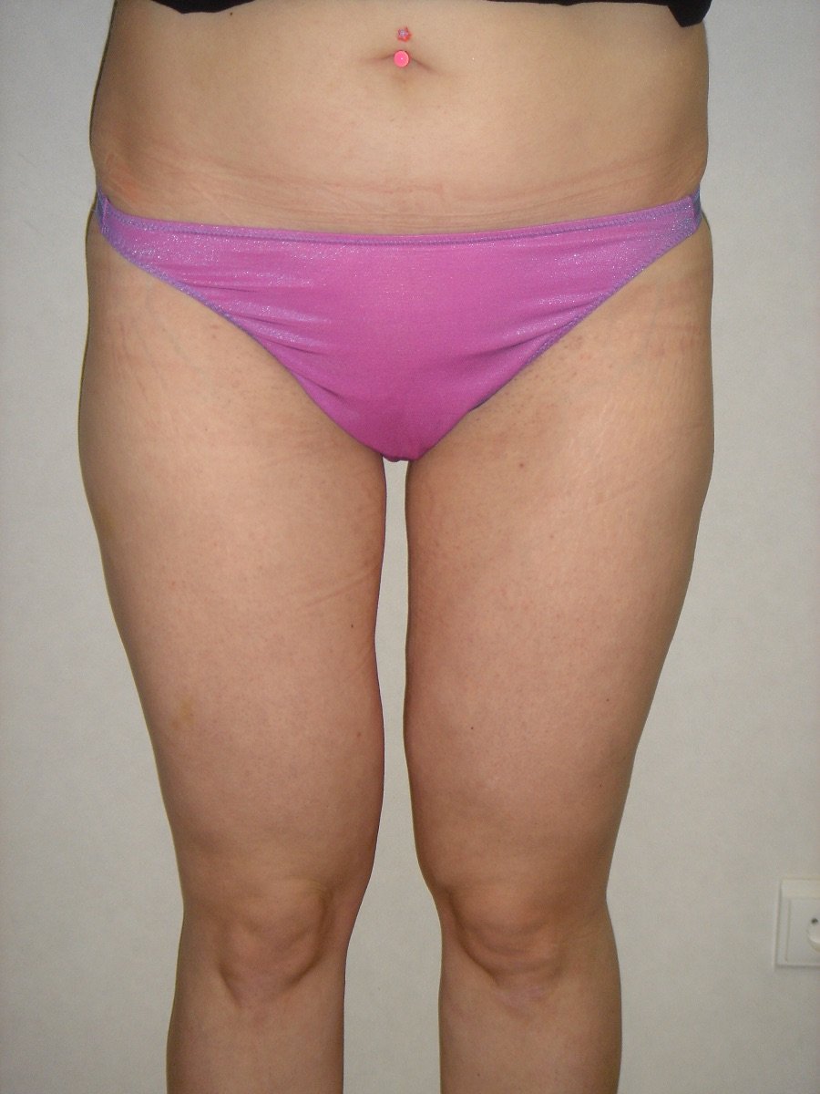 before and after photo