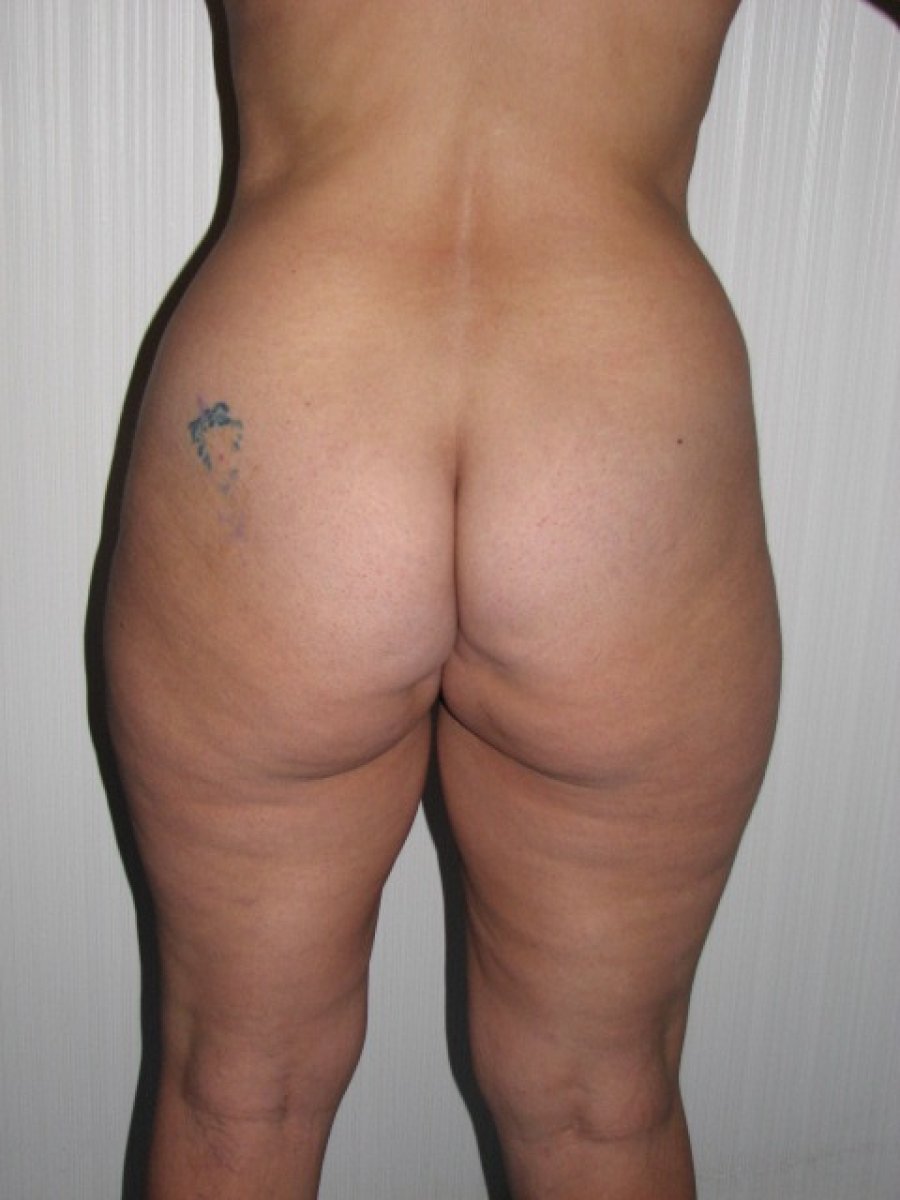 before and after photo