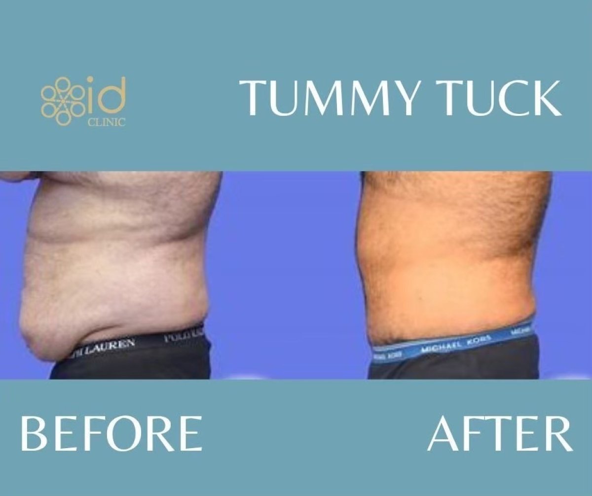 before and after photo