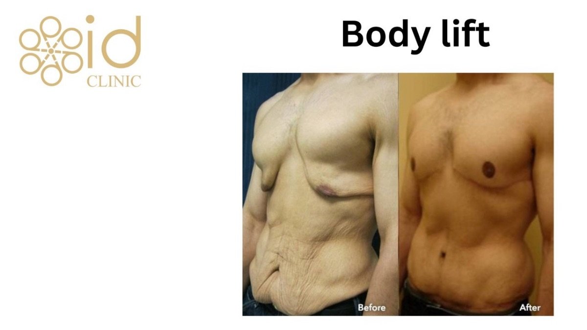 before and after photo