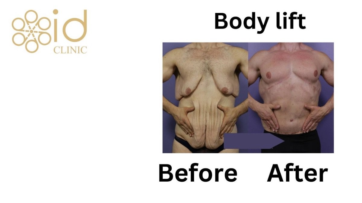before and after photo