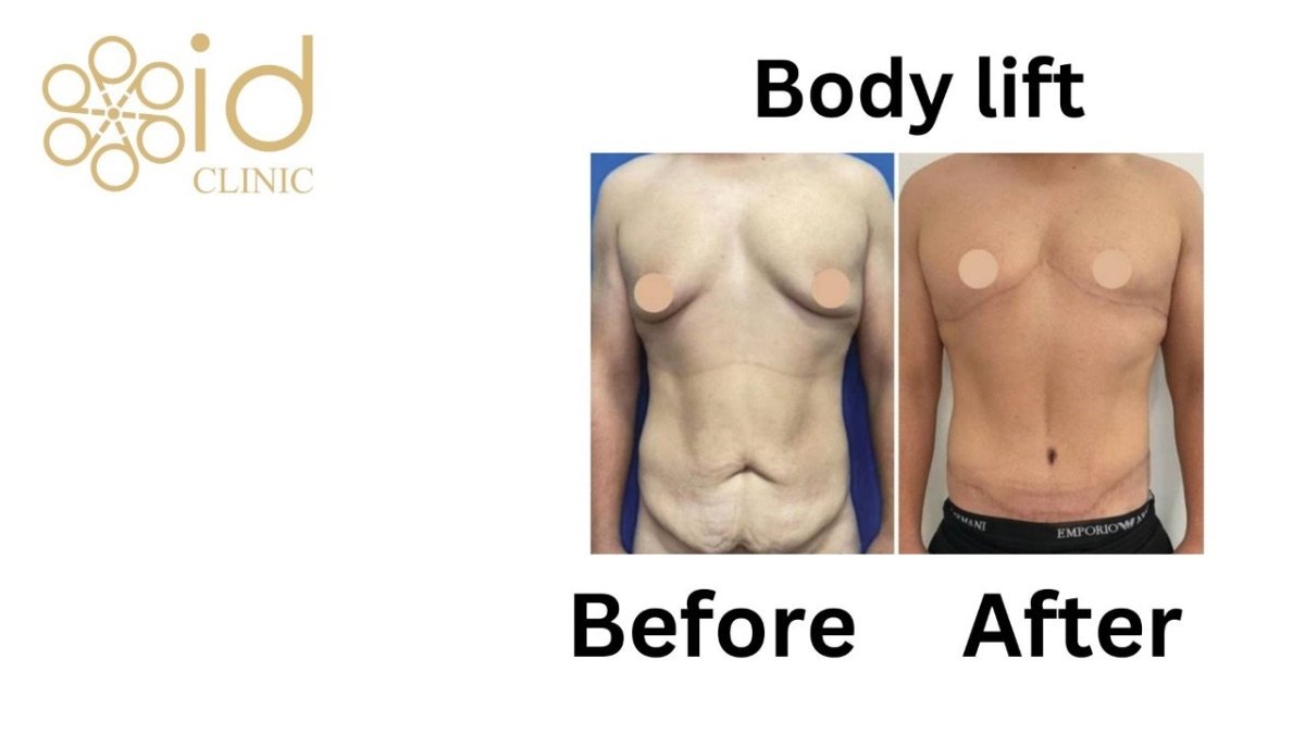before and after photo