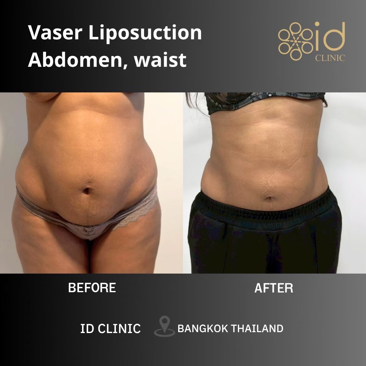 before and after photo