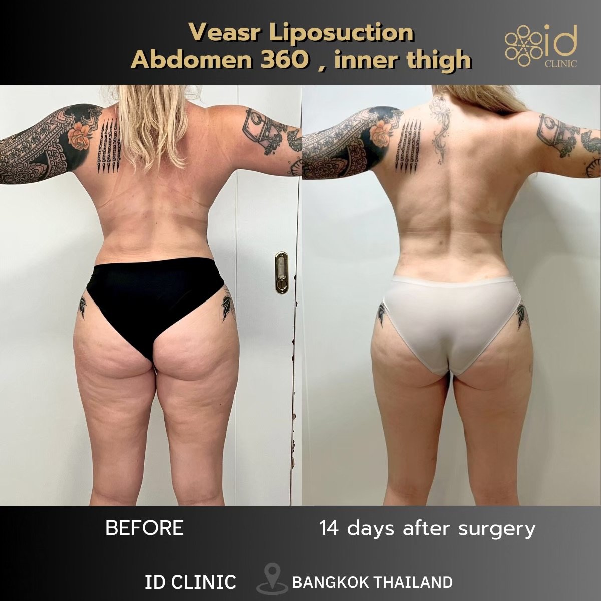 before and after photo