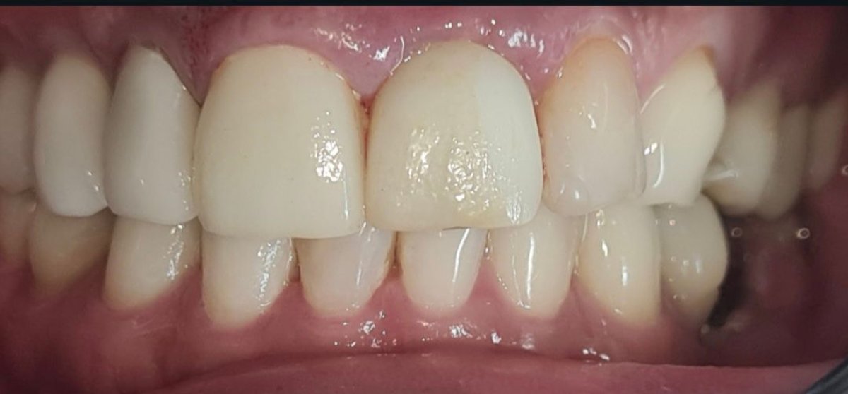 before and after photo