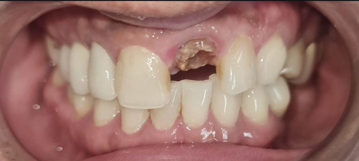before and after photo