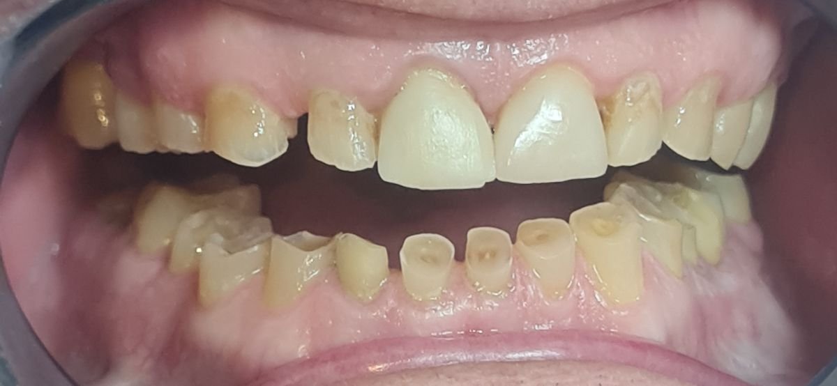 before and after photo