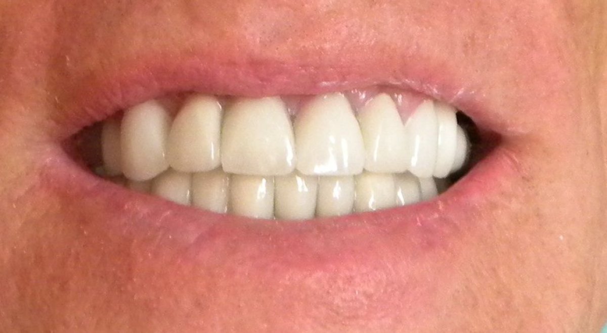 before and after photo
