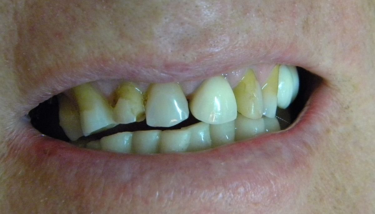 before and after photo