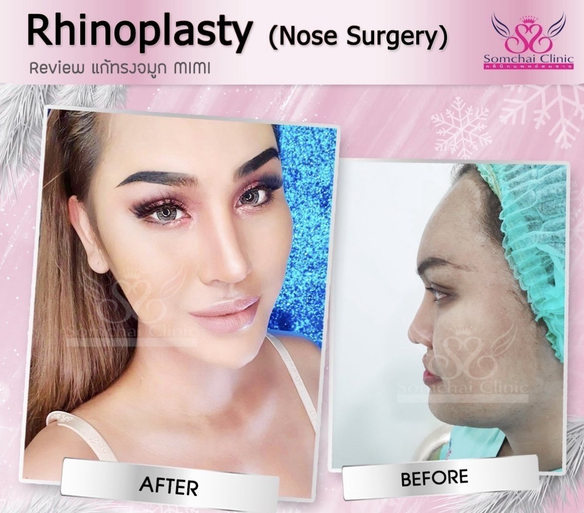 before and after photo