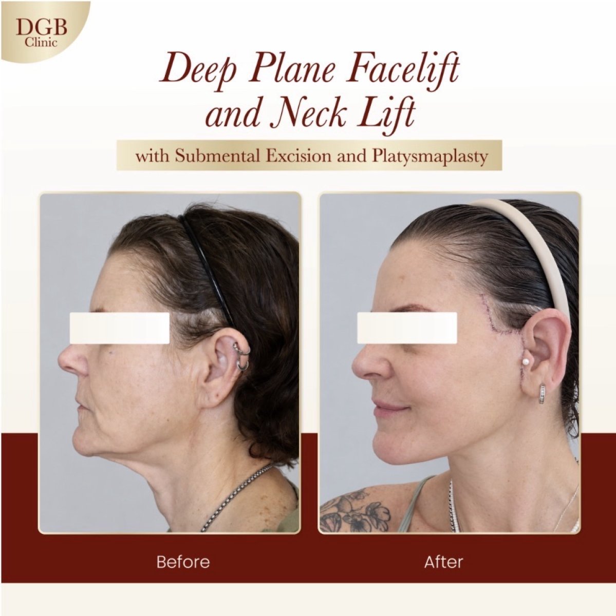 before and after photo