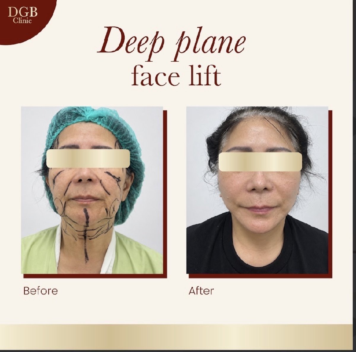 before and after photo