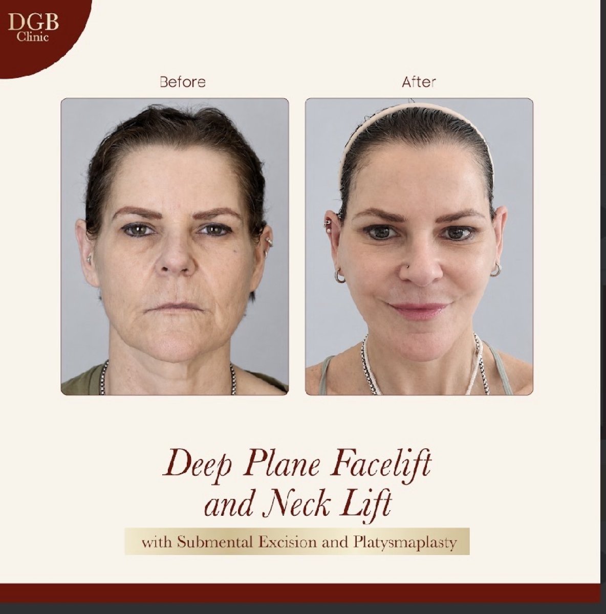 before and after photo
