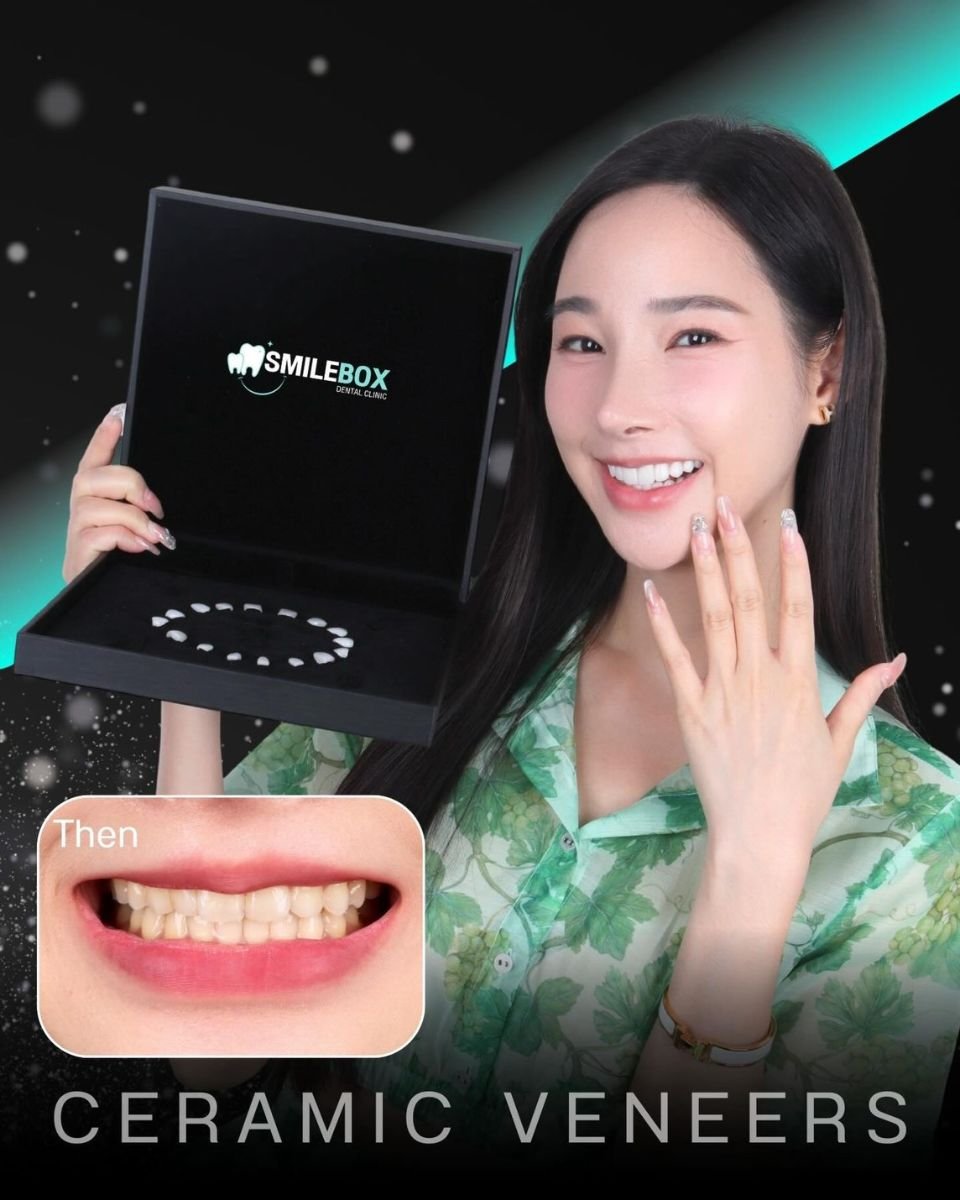 Before and after Emax veneers result at SmileBox Dental Clinic - Thonglor, Sukhumvit Branch