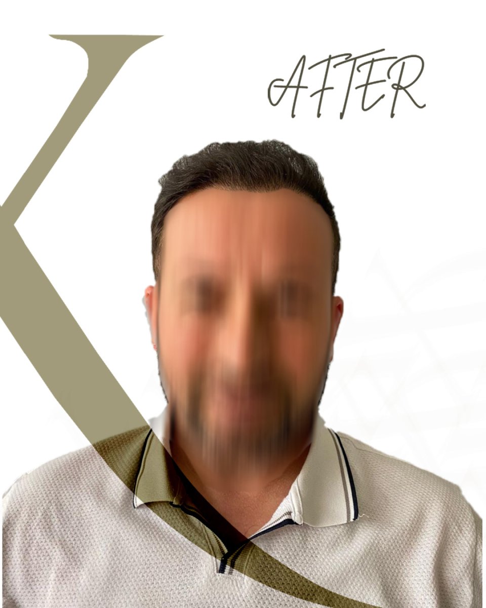 before and after photo