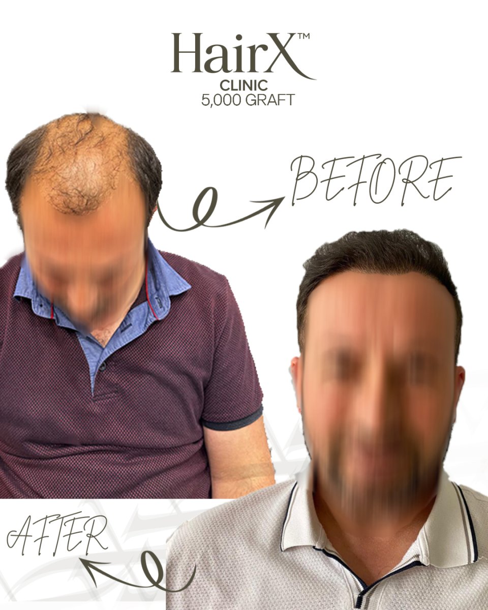 before and after photo