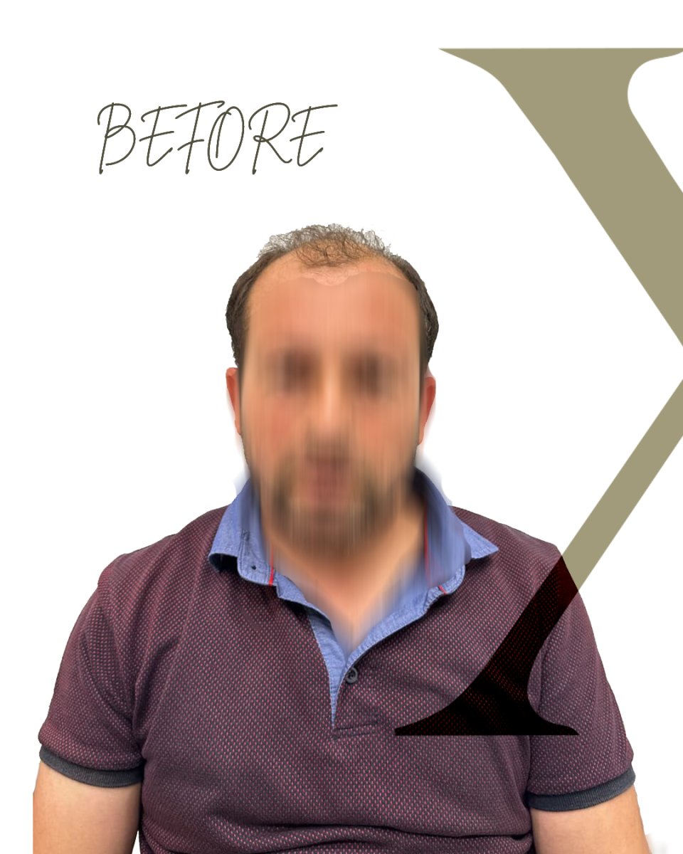before and after photo