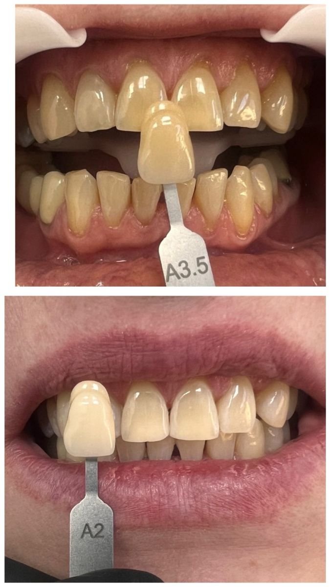 before and after photo