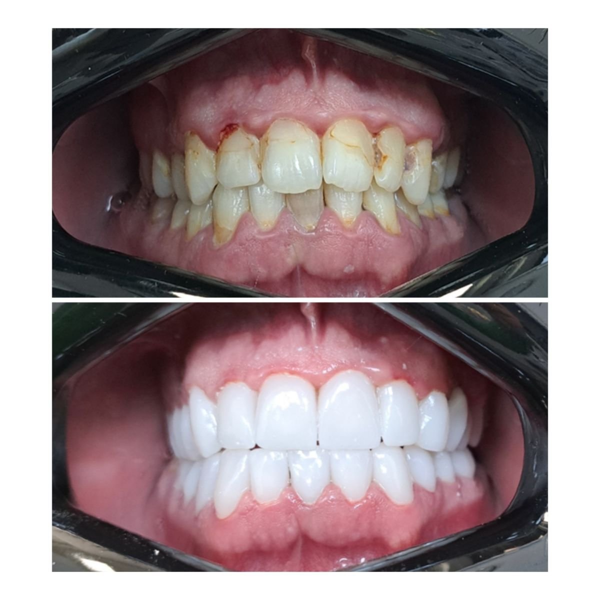 before and after photo