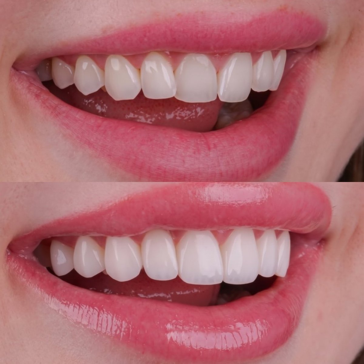 before and after photo