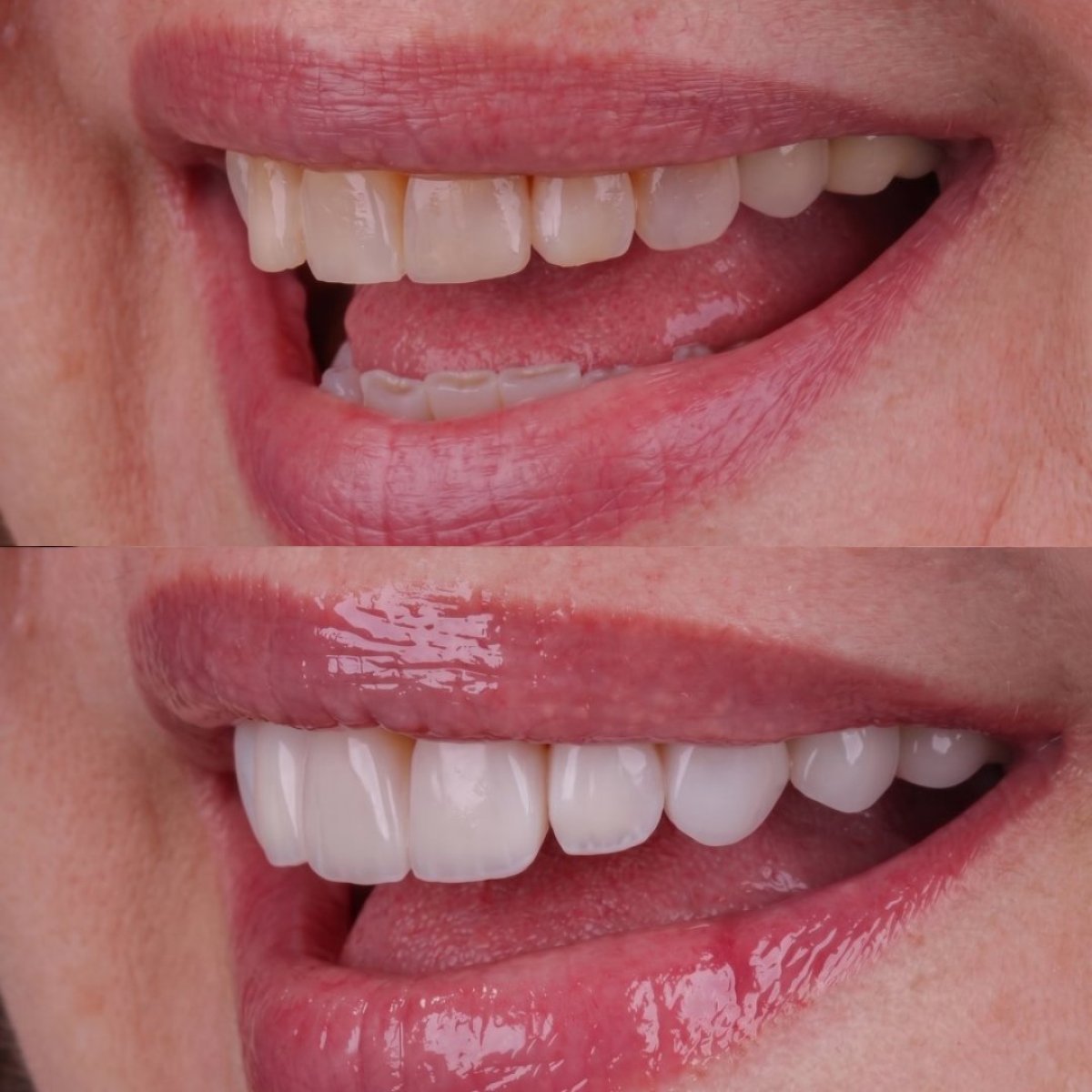 before and after photo