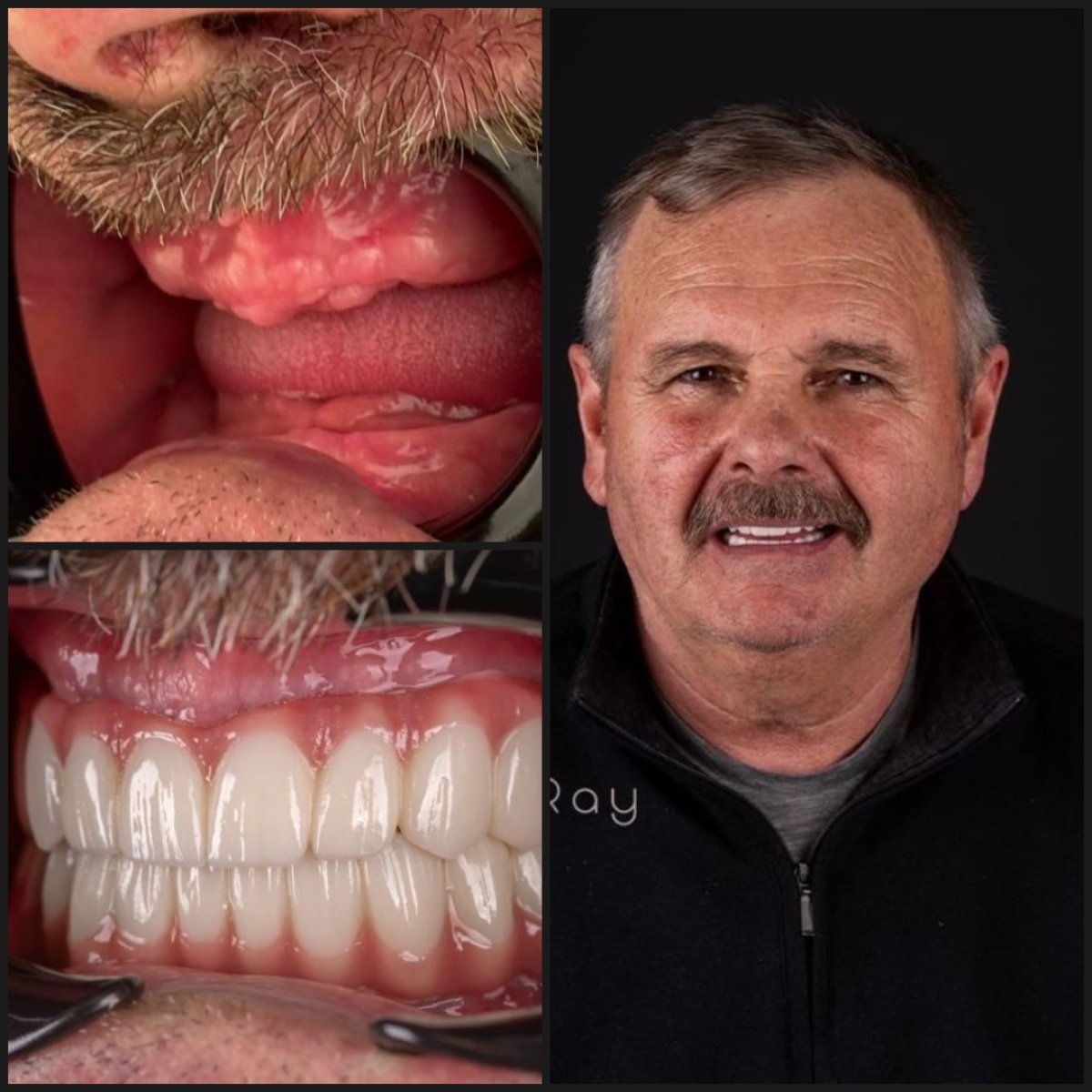 before and after photo