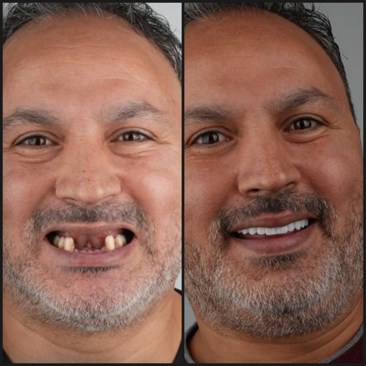 before and after photo