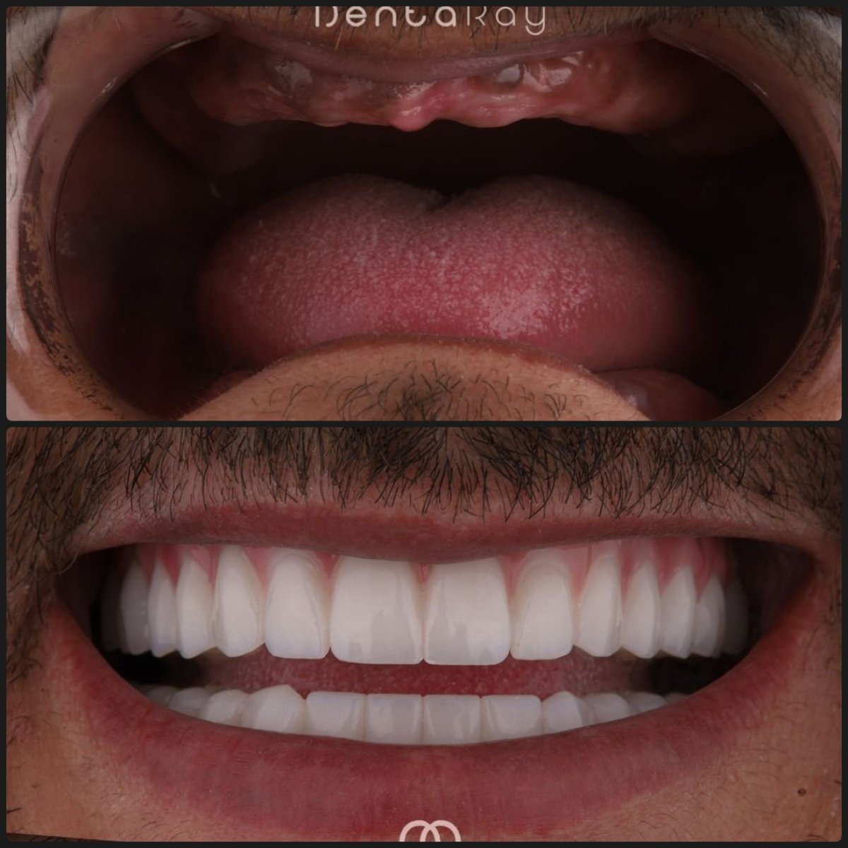 before and after photo