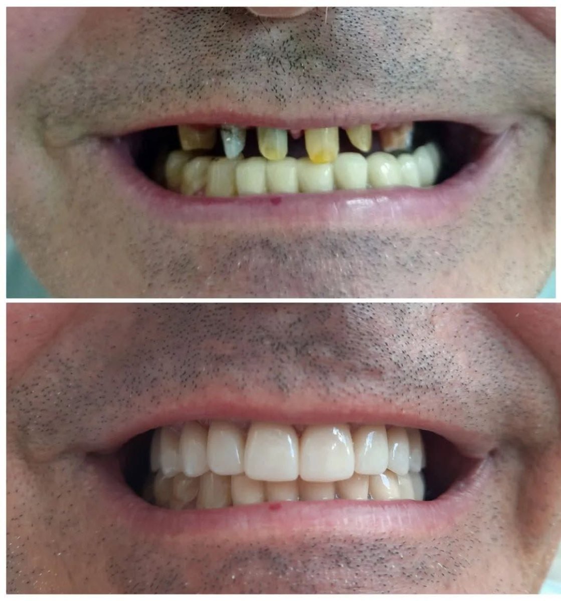 before and after photo