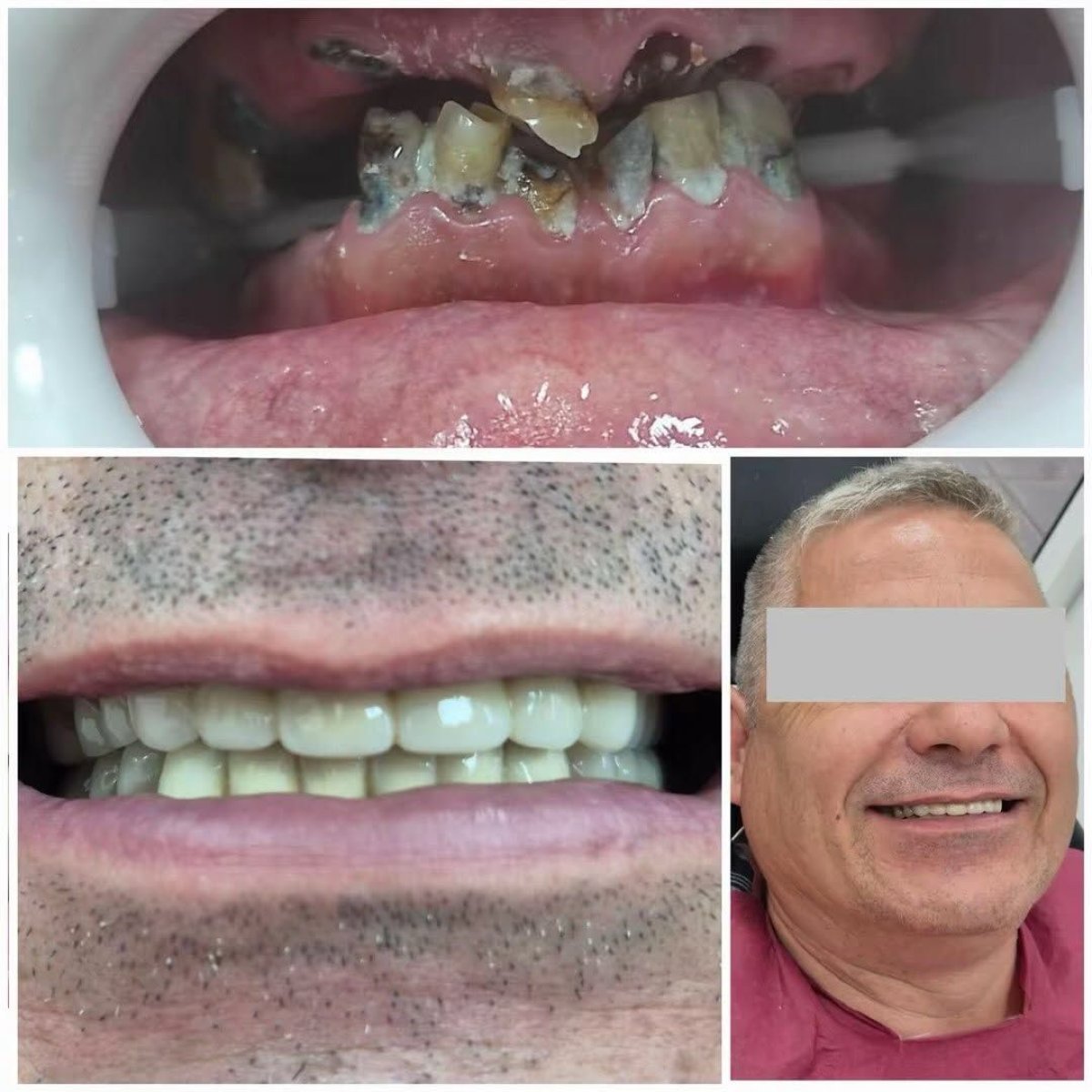 before and after photo