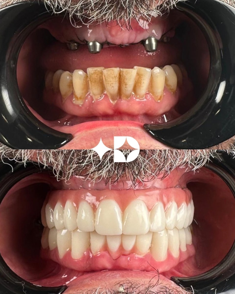 before and after photo