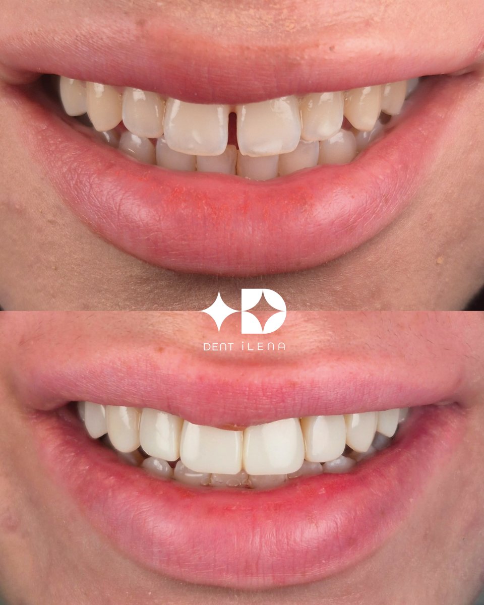 before and after photo
