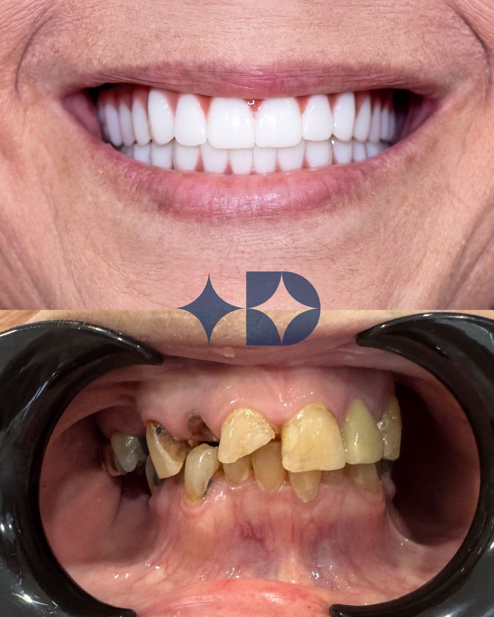 before and after photo