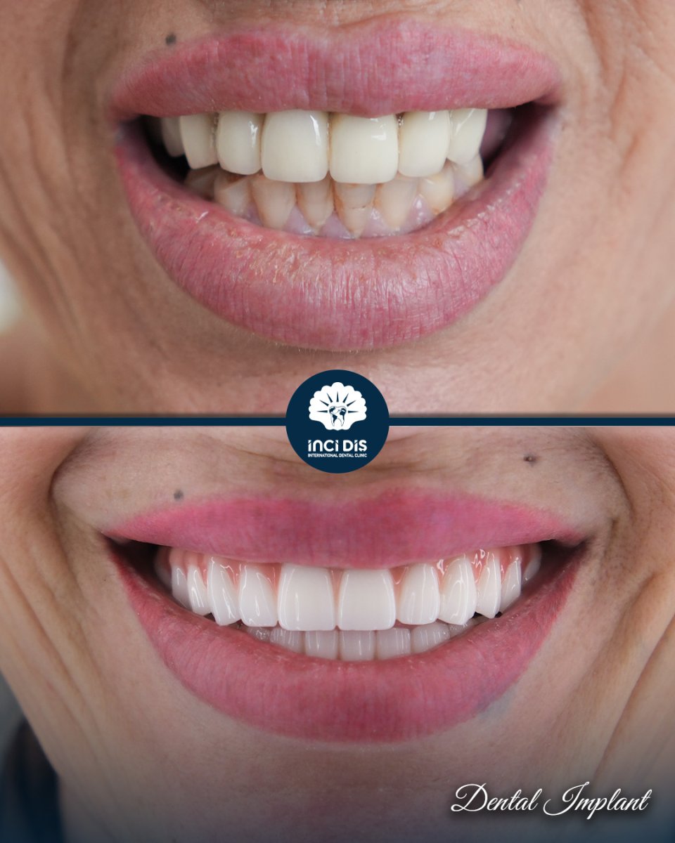 before and after photo