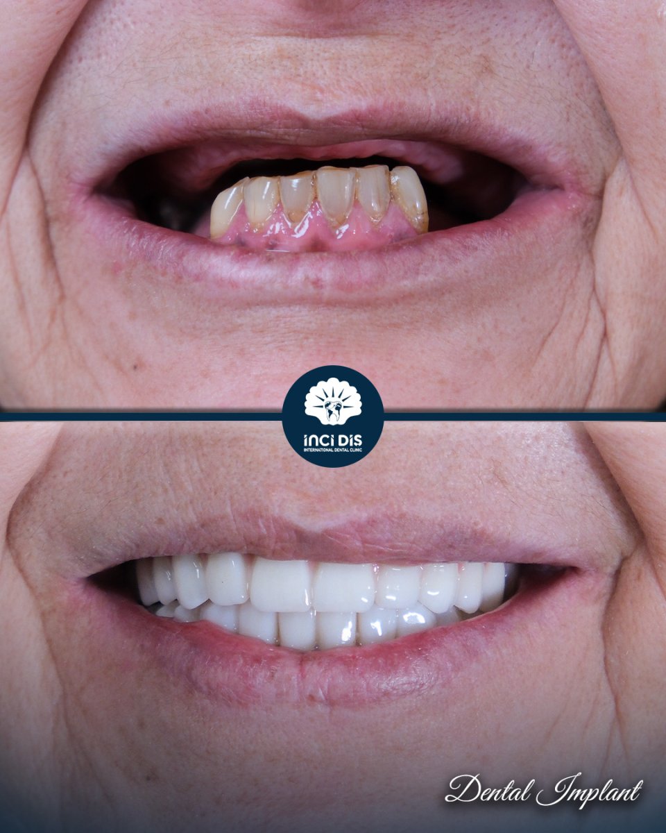 before and after photo
