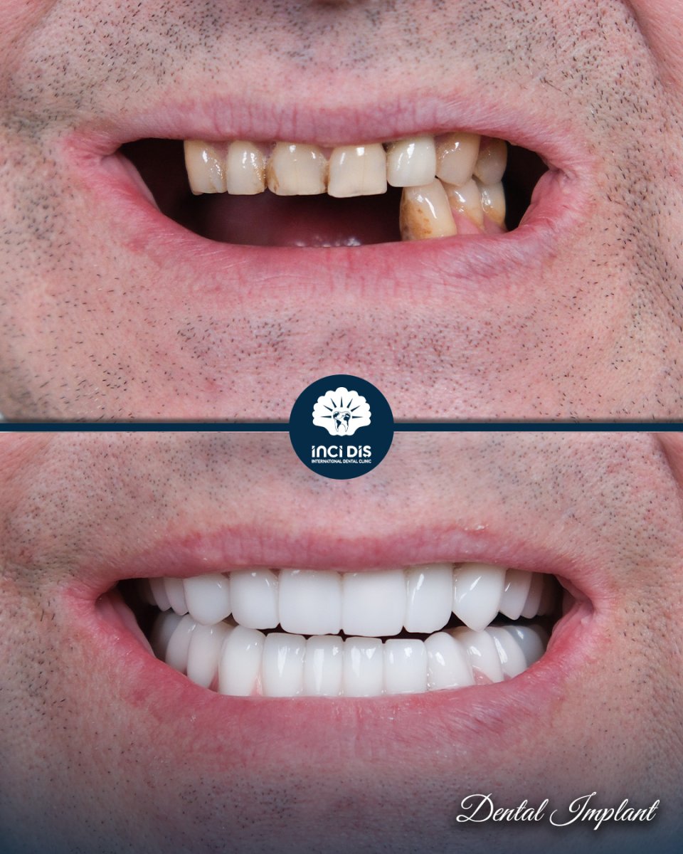 before and after photo