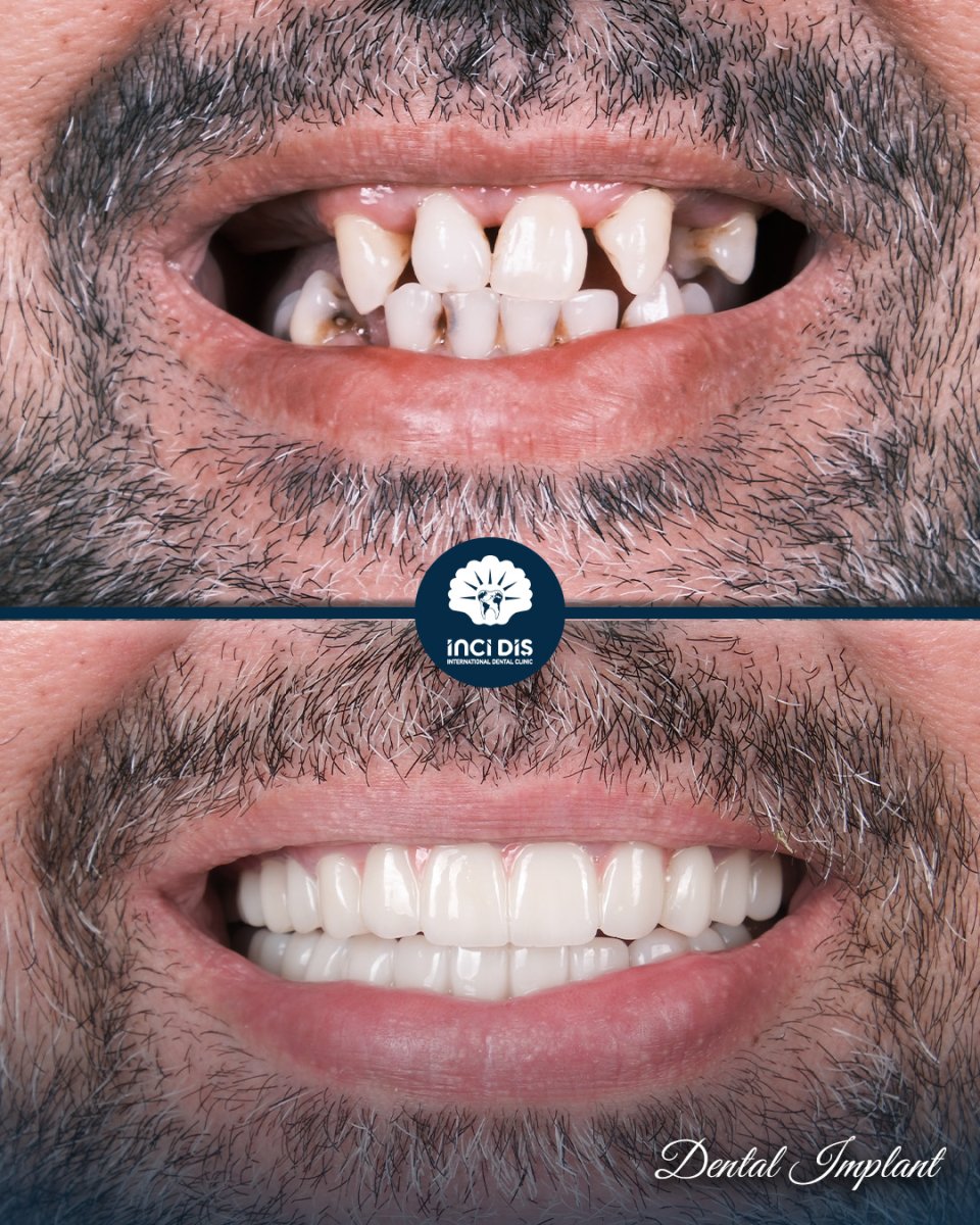 before and after photo