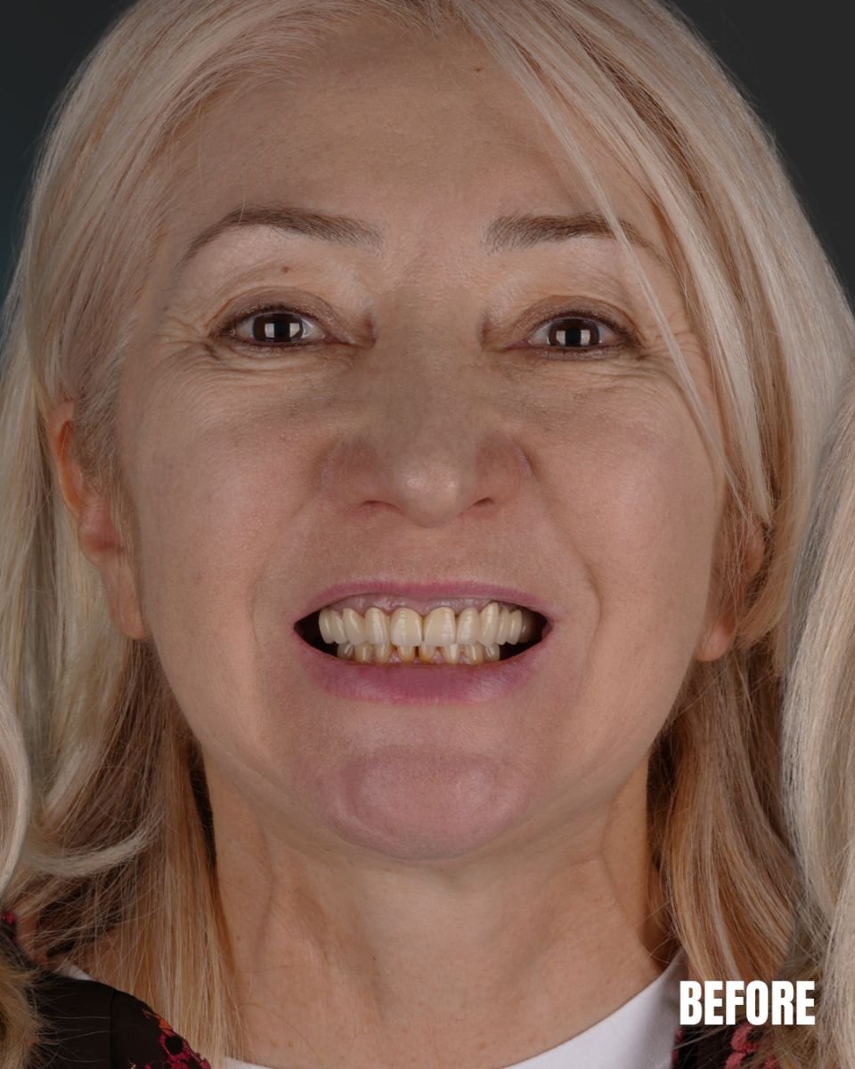 before and after photo