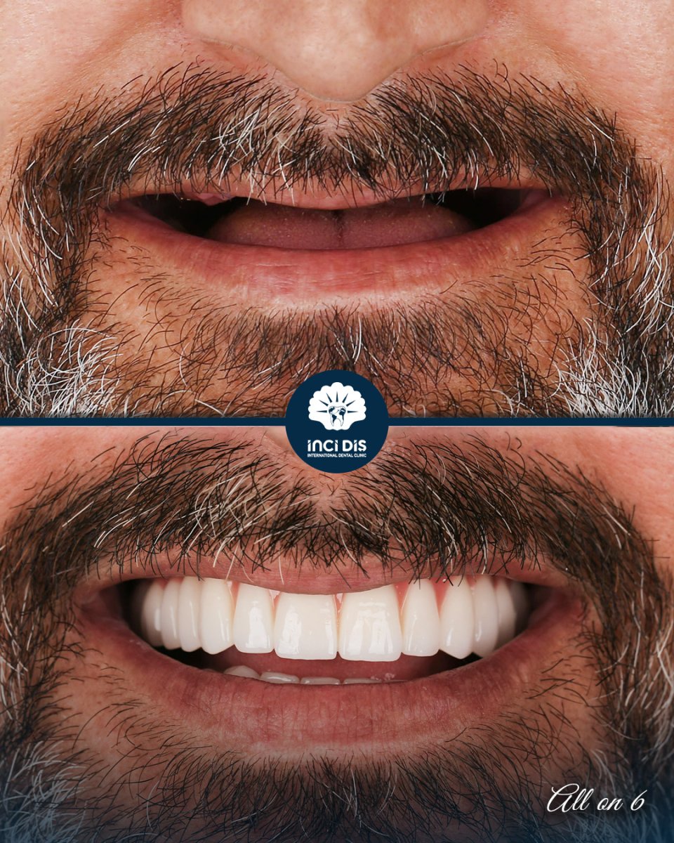 before and after photo