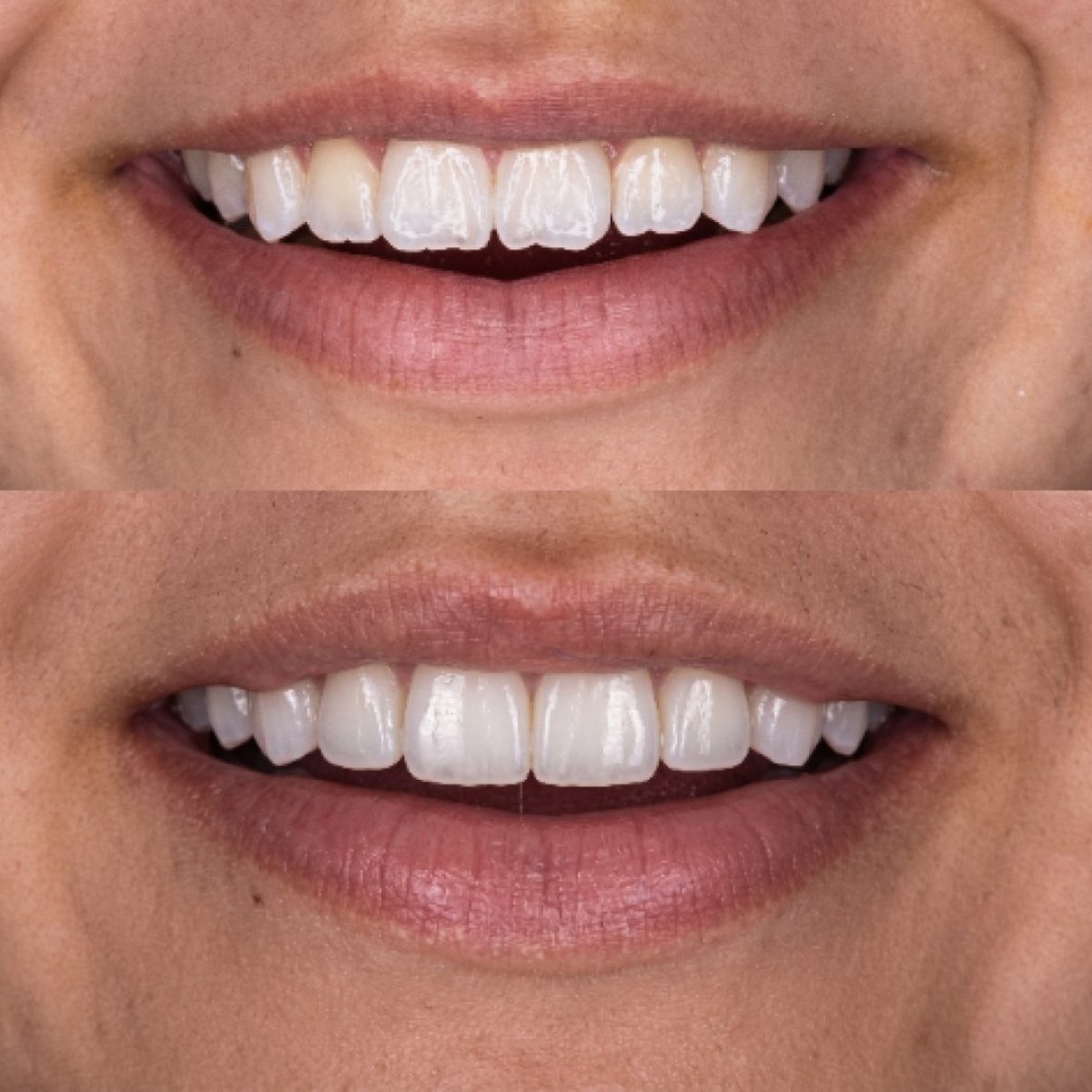 before and after photo