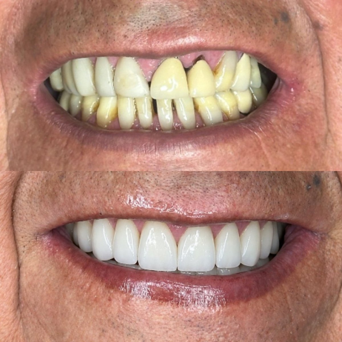 before and after photo