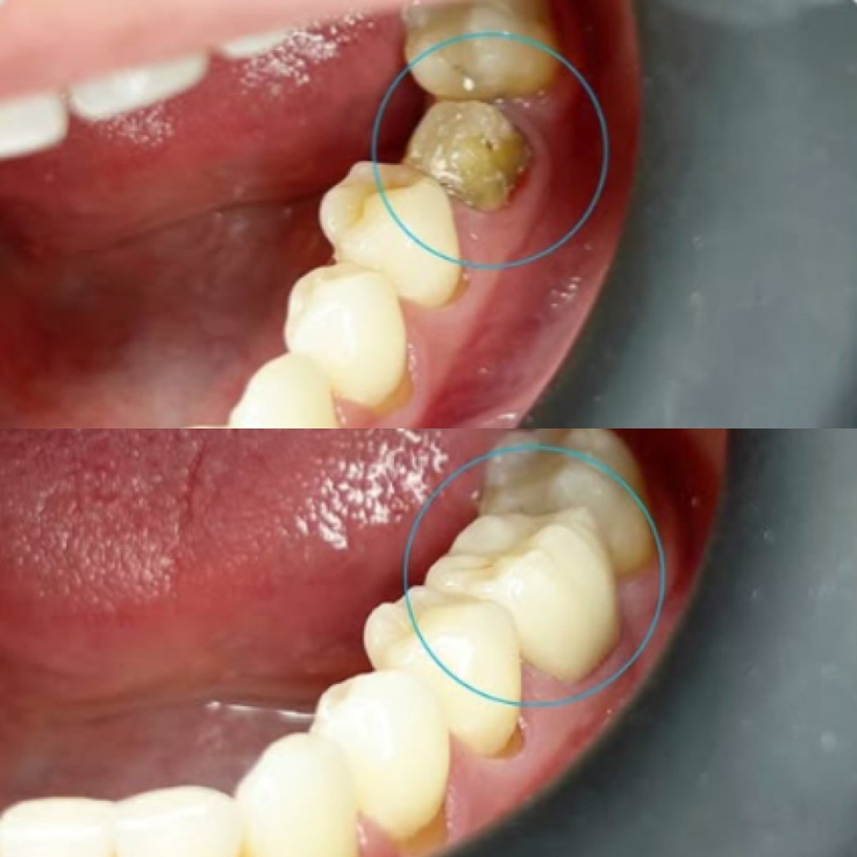 before and after photo