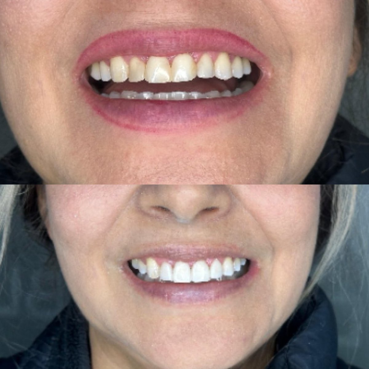 before and after photo