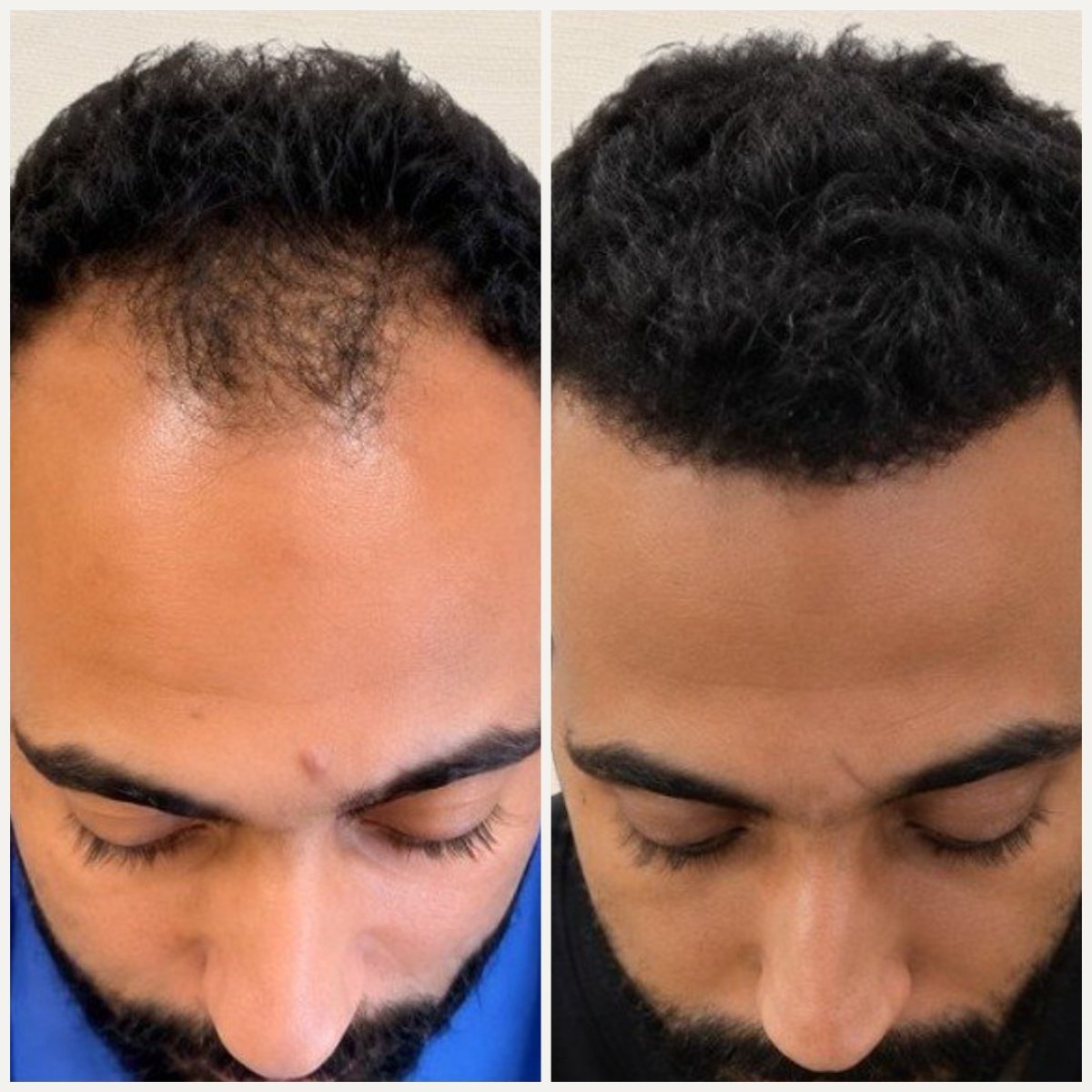 before and after photo