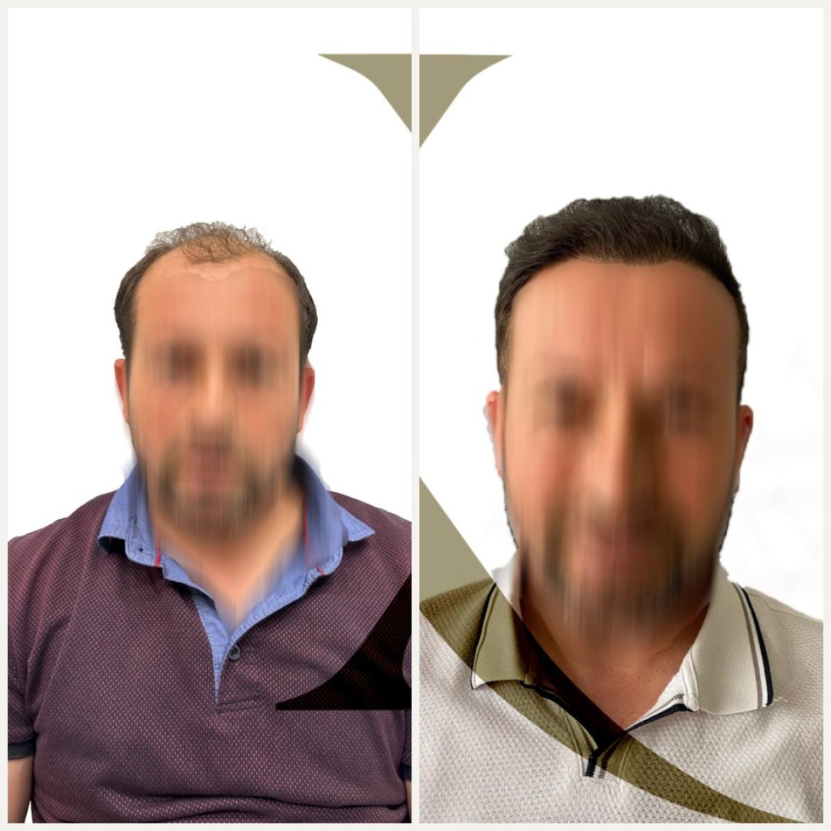 before and after photo