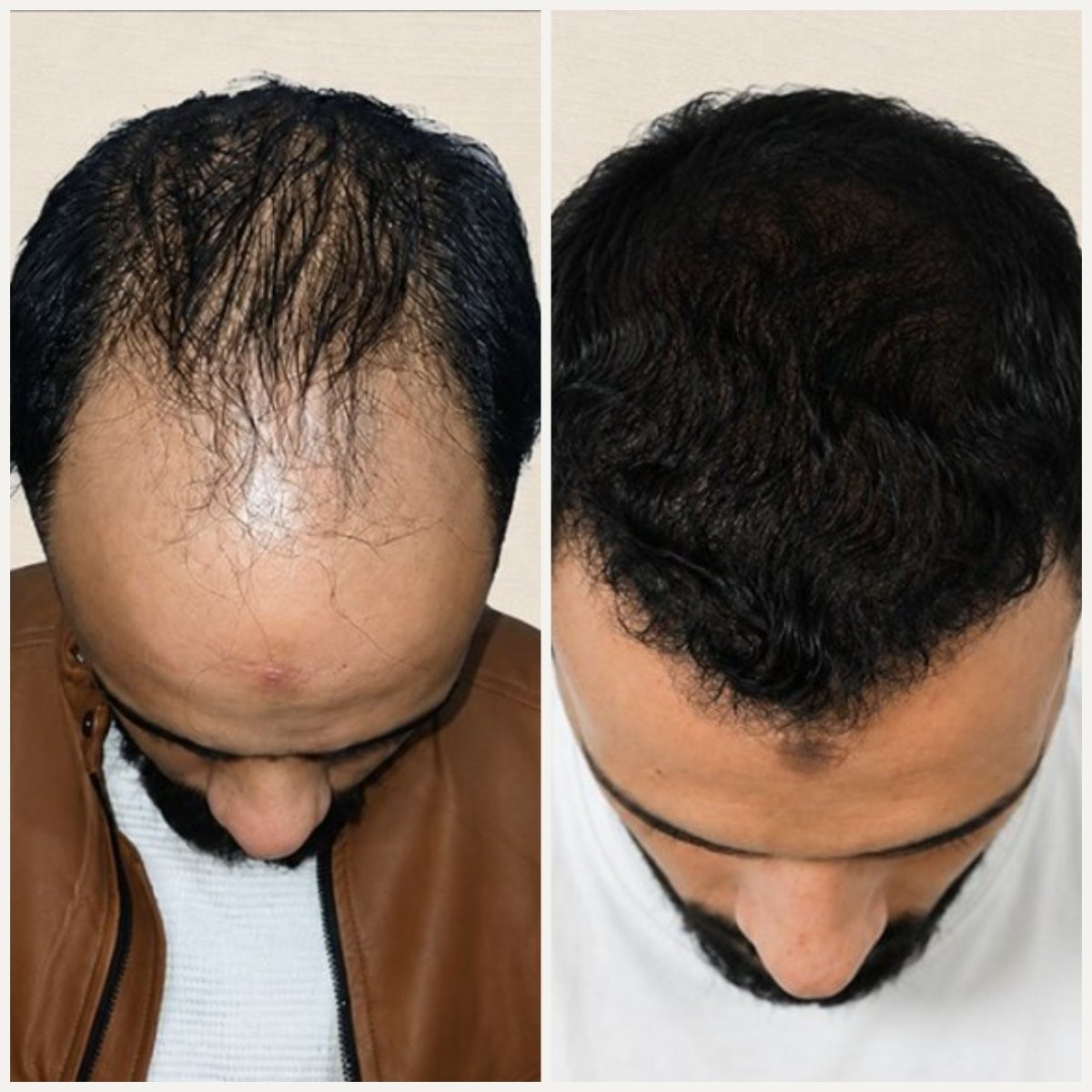 before and after photo