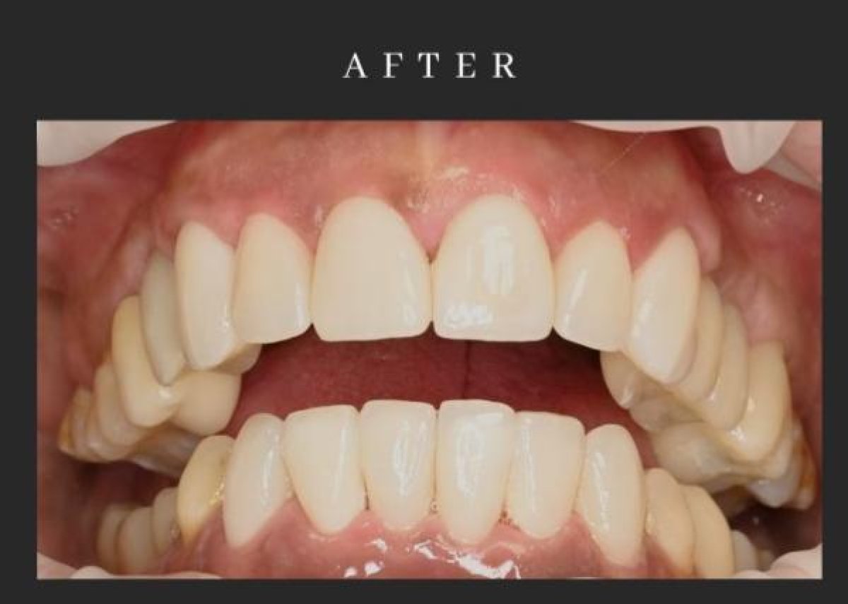 before and after photo