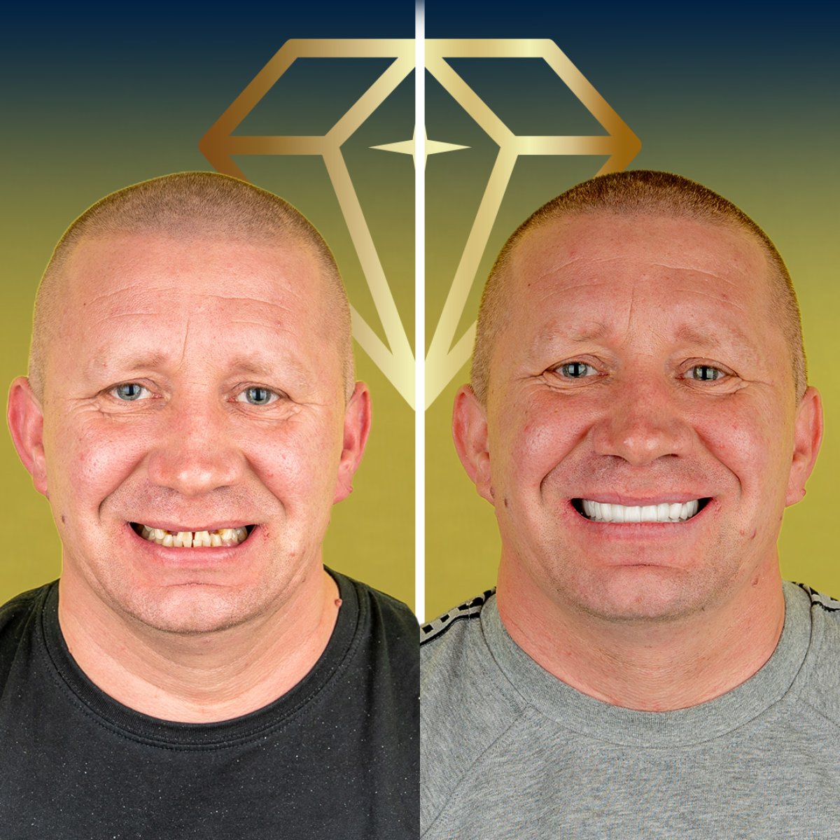 before and after photo