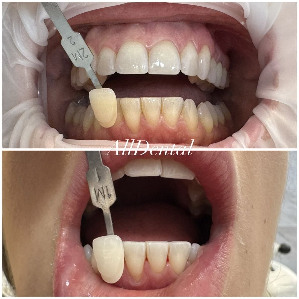 before and after photo