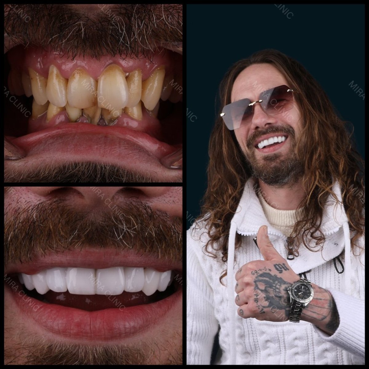 before and after photo